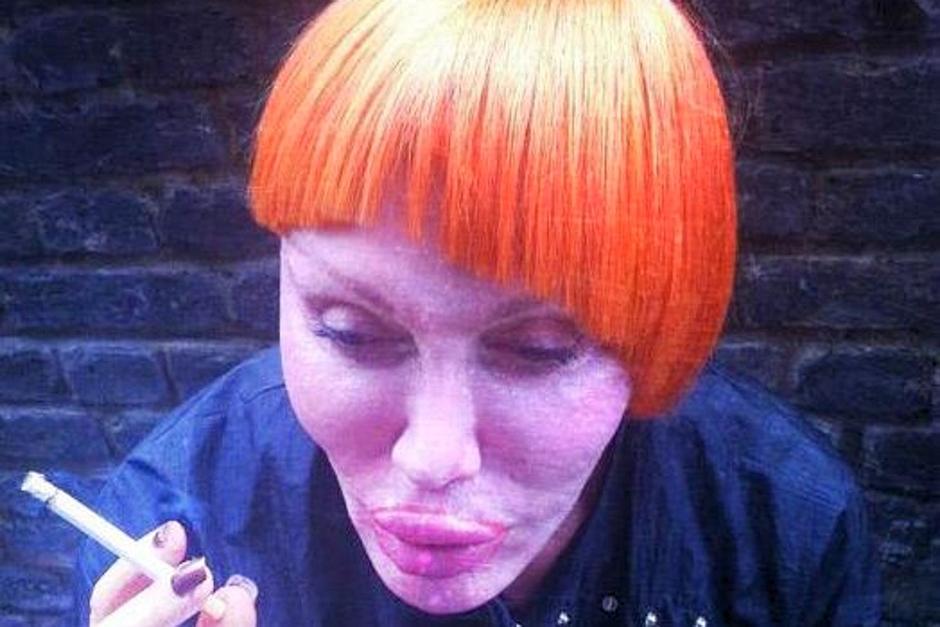  Pete Burns has spent thousands on plastic surgery