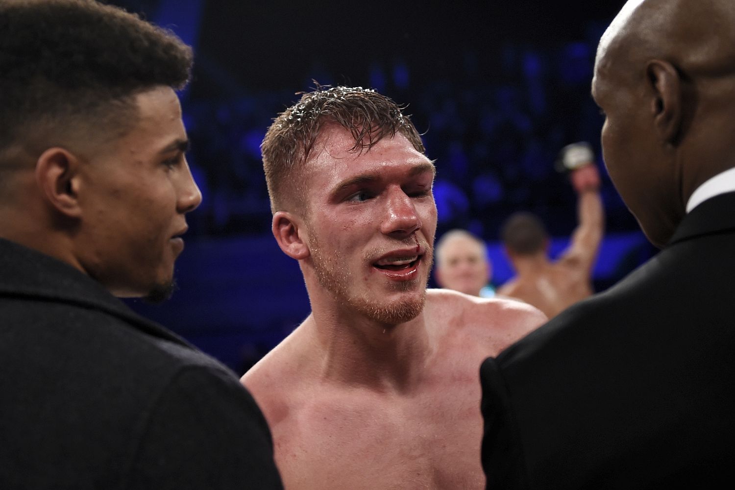 Nick Blackwell suffered bleeding on the brain after defeat