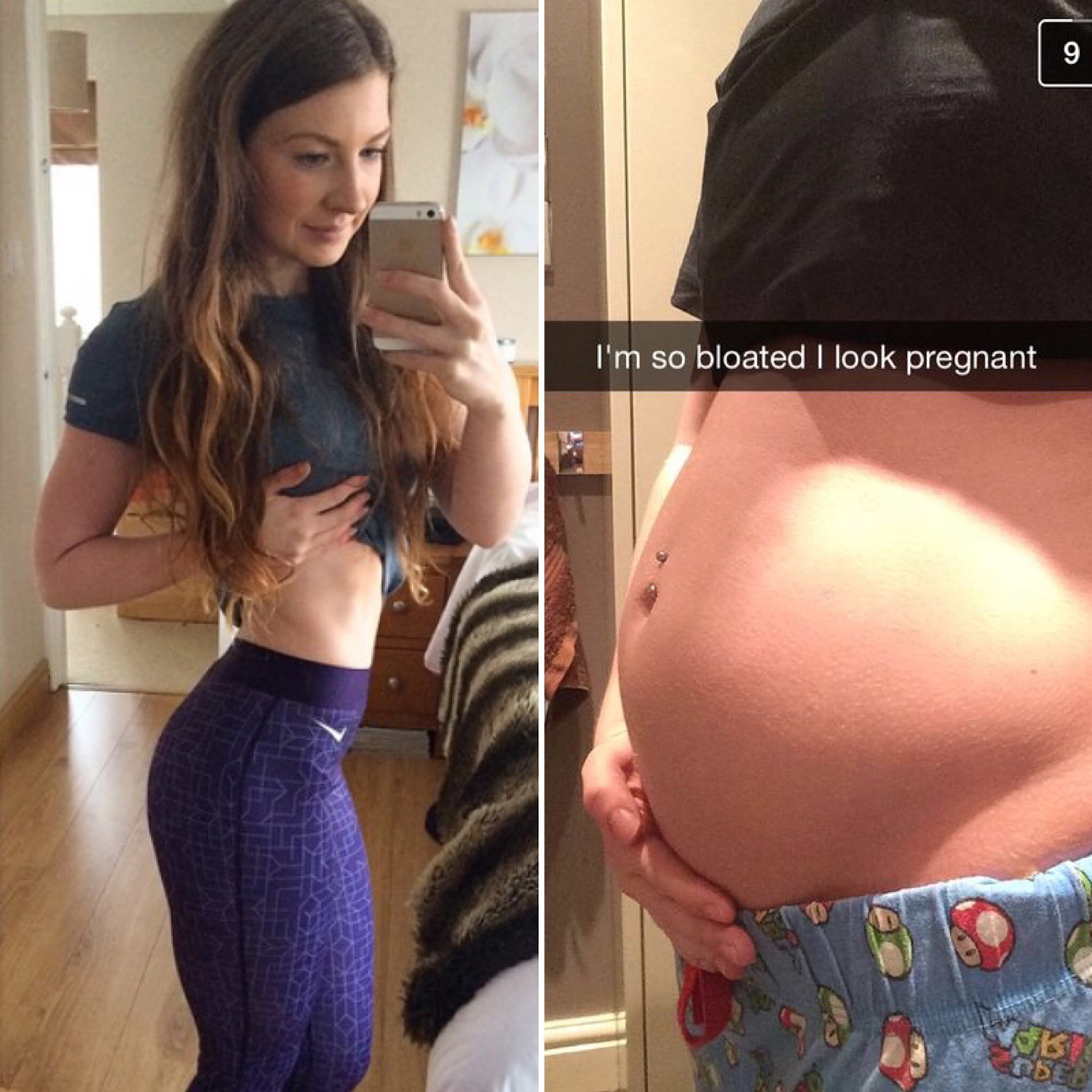  Tiny-framed Beth Trueman, 22, turned to the FODMAP diet when her IBS flared up at university