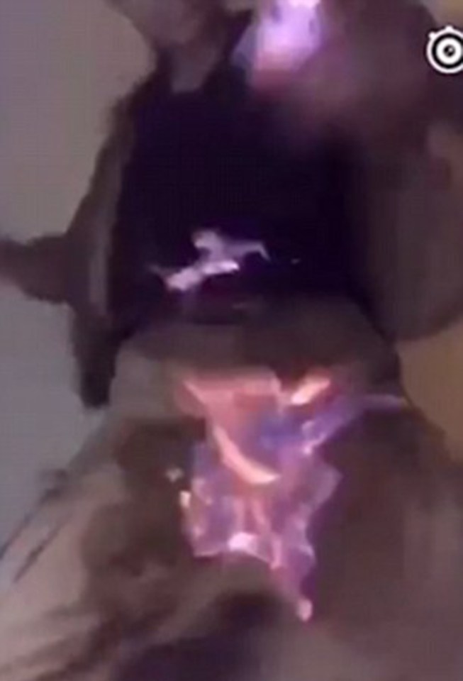  Clearly in pain, he leaps up and desperately tries to put out the fire by hitting himself