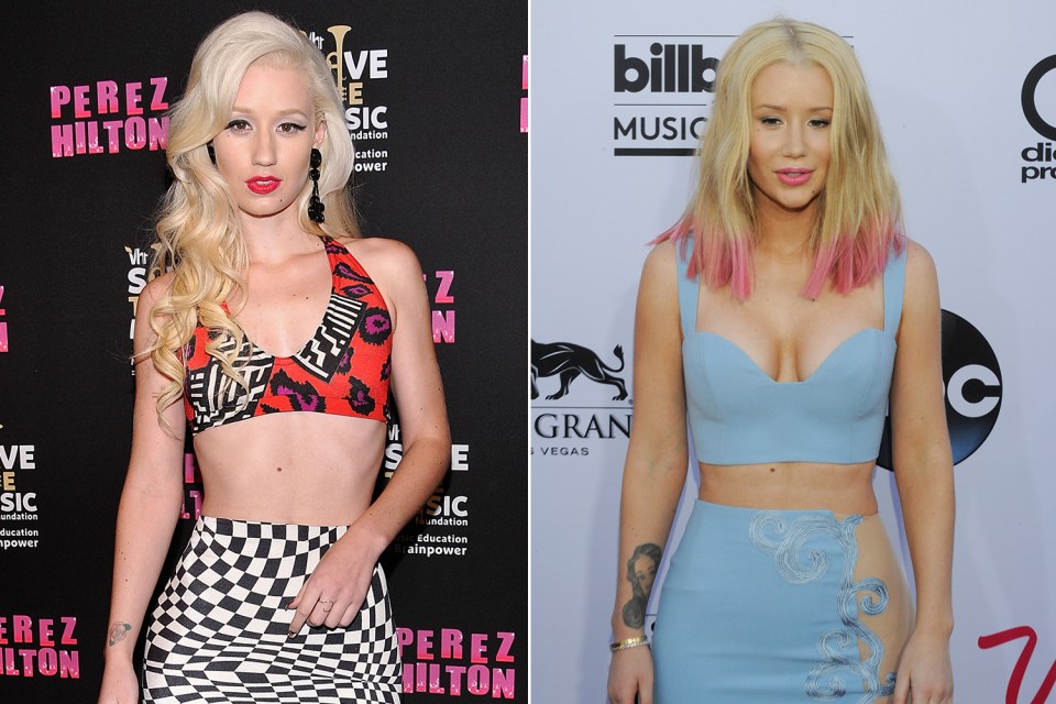  Iggy Azalea revealed all to Vogue about her op, pictured left before and right after