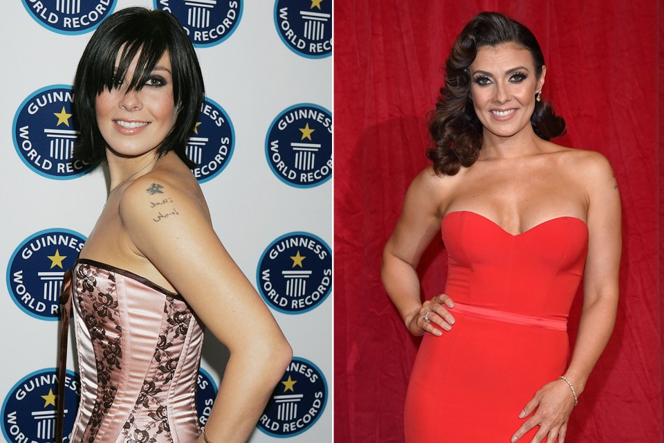  Kym Marsh pictured pre-op, left, and flaunting her bigger cleavage, right