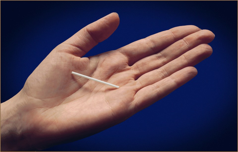  This implant is inserted under the skin in your arm