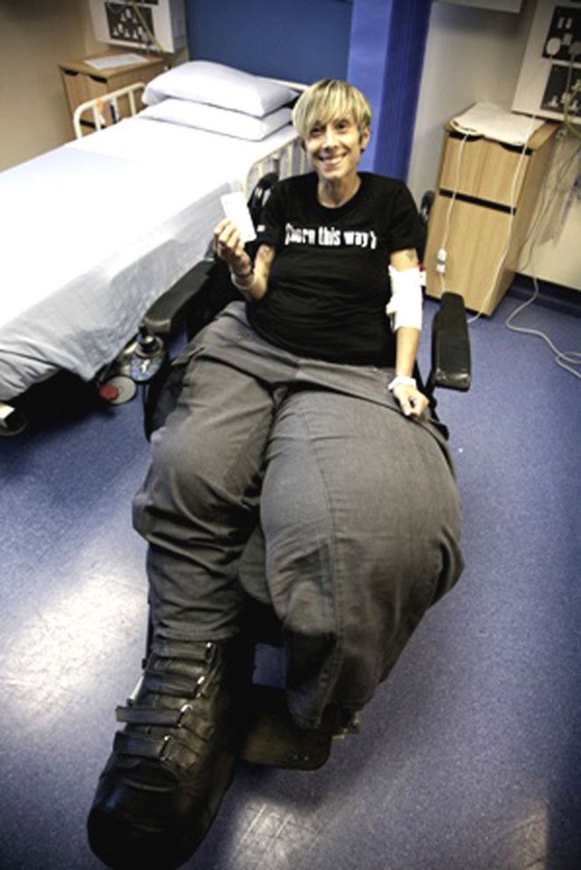  Mandy Sellars' legs weighed 17 stone at their biggest, although the top of her body was a size 10