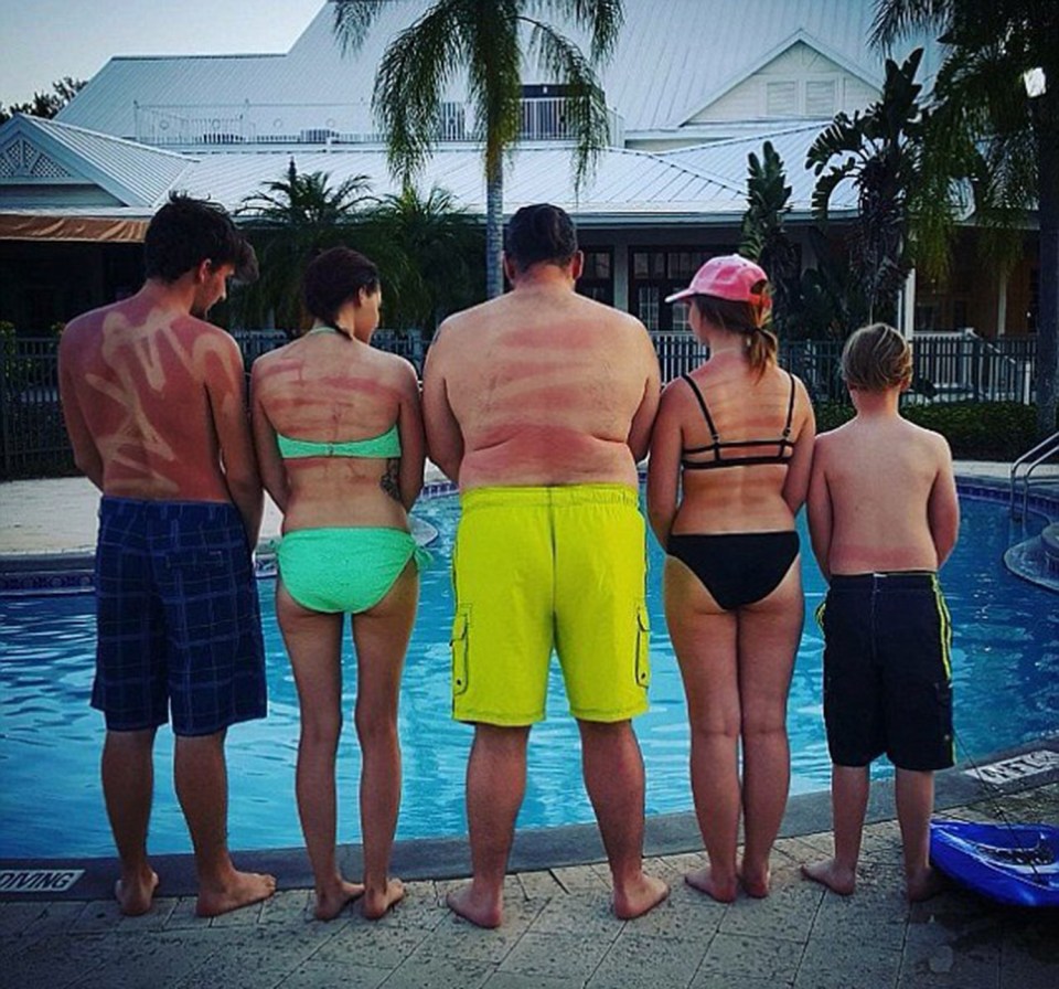  This family soon discovered the perils of failing to rub in their spray-on suncream