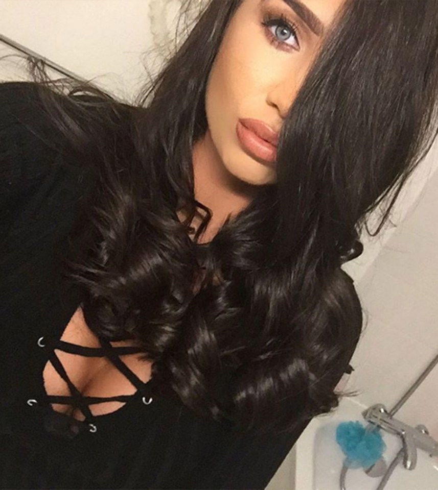  Lauren has become famous for her big lips - but trolls told her she was freakish