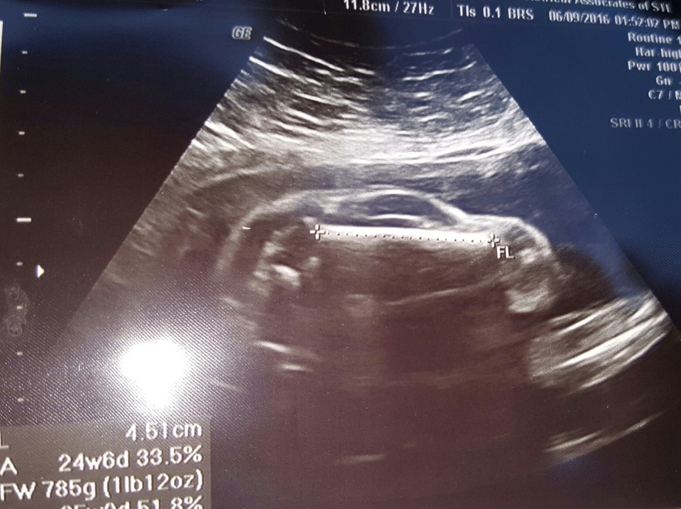 Would you look at FIAT... this is the odd ultrasound which looks like a car