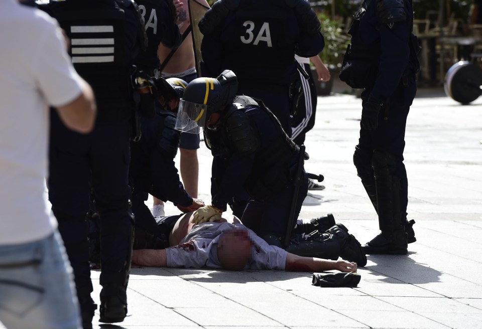 Police personnel attend to an injured fa