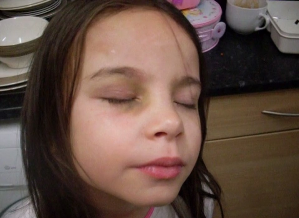  Ellie has a black eye in a home video taken by abusive Butler. A family judge dismissed charges against him in 2011