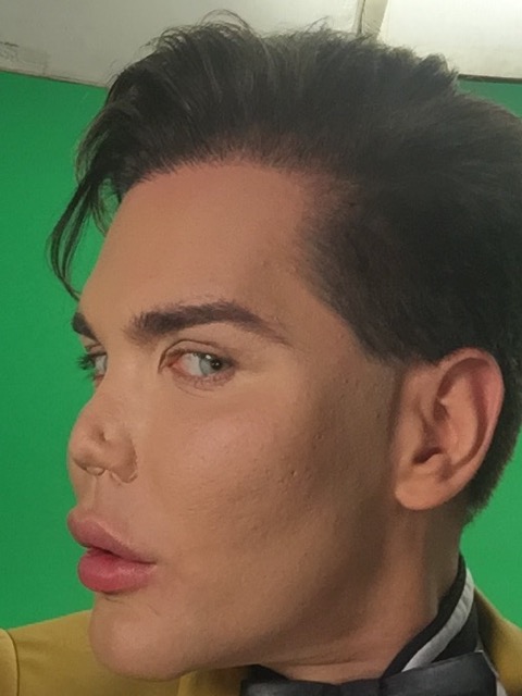  Rodrigo Alves had a nose job in February, but he suffered necrosis which meant his flesh rotted