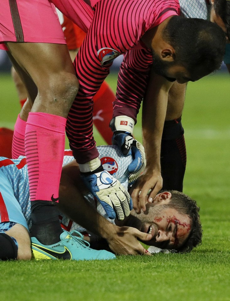  Gokhan Gonul lies bloodied after an aerial challenge