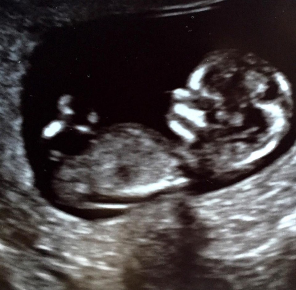 Katherine Hiegl and Josh Kelley sonogram