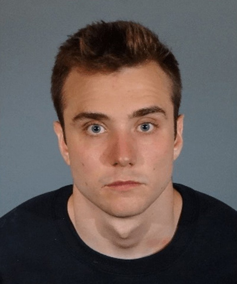  Gay Youtuber Calum McSwiggan claims he was beaten up by three men outside a club, but police disagree