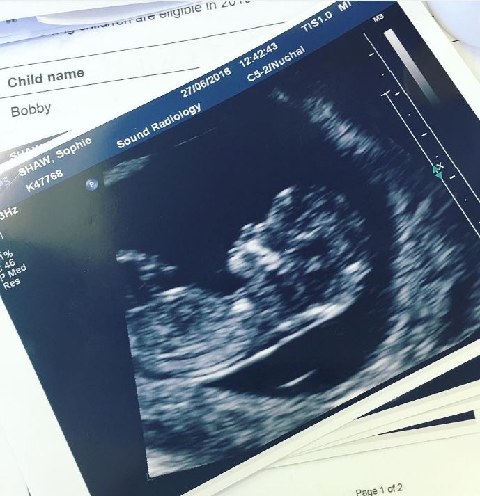  She posted her 12-week baby scan alongside the baby name question