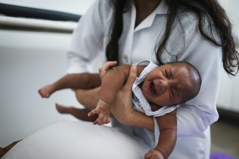  Hundreds of babies have been born with microcephaly, a condition that causes children to be born with abnormally shrunken heads, since the outbreak of Zika