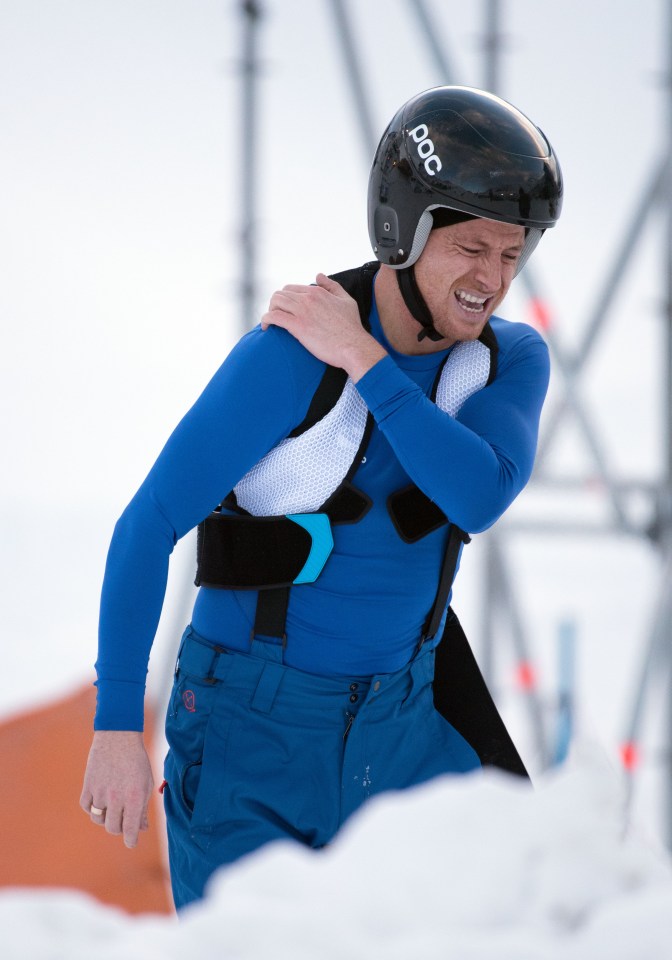  EastEnders' Joe Swash clutches his shoulder in agony after breaking it during training