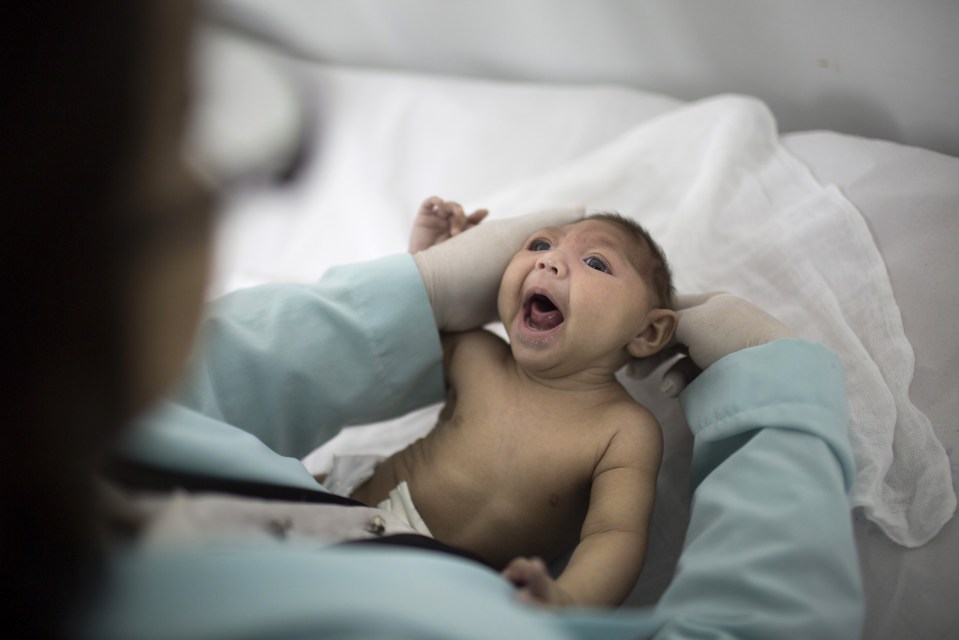  The zika virus means babies are born with an abnormally small head