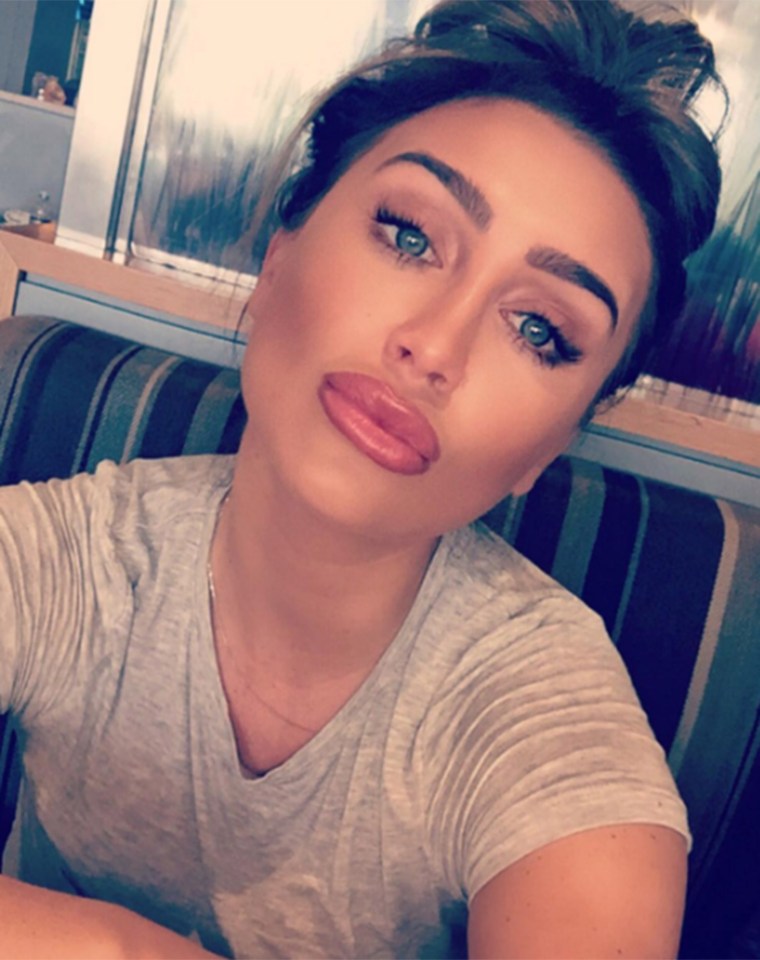  Lauren recently had her lip-fillers removed after plumping up her pout for the last five years