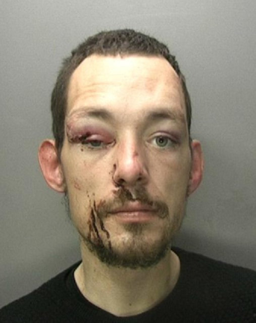  Thug . . . Kyle Copson was left battered and bruised after the owners of a TV he tried to steal got hold of him