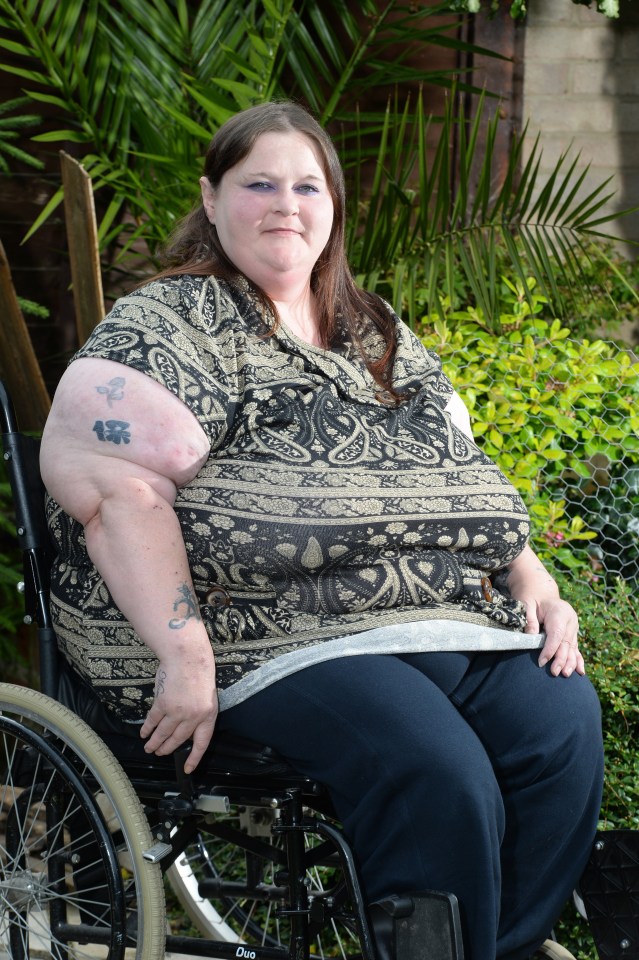  Pain ... Annette suffers chronic systemic juvenile rheumatoid arthritis, made worse by her size 60HH breasts