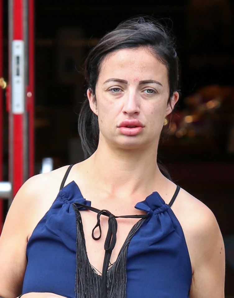 Reality TV star Chantelle Houghton revealed painful looking swollen lips as she ditched her make-up for the day