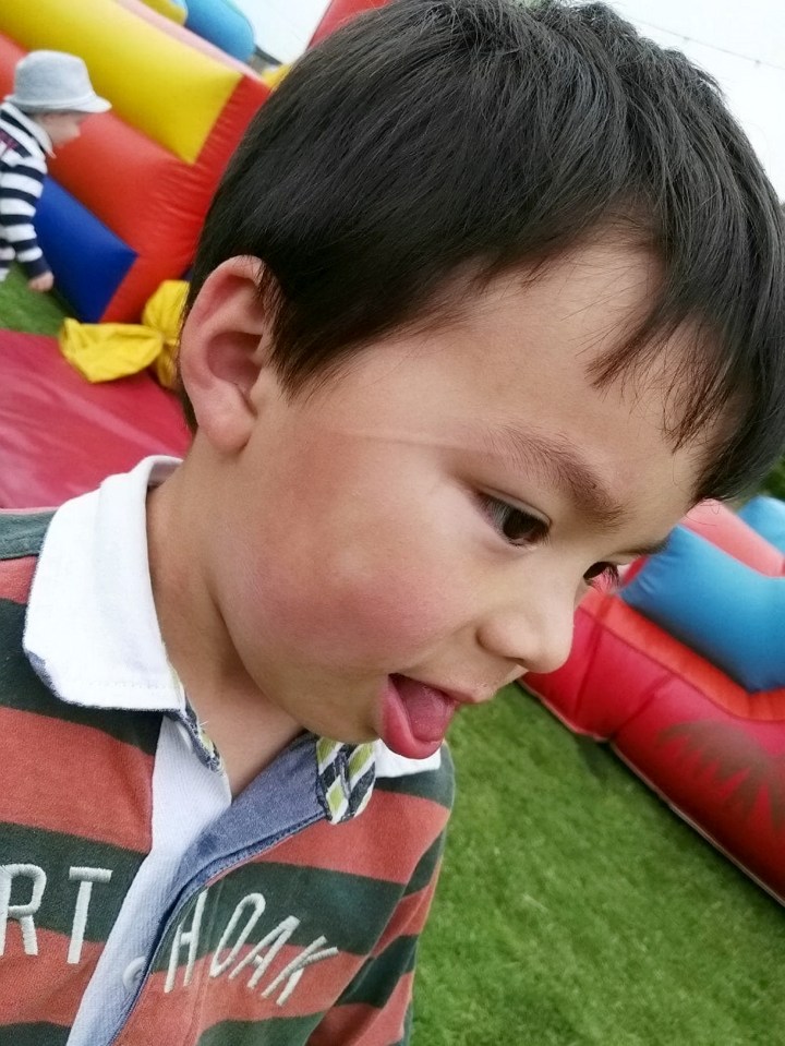  The four-year-old was left with marks just an inch from his eye