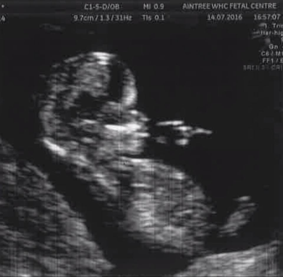  Steph revealed her scan to the Loose Women panel