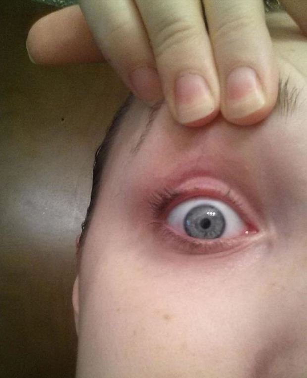  An Imgur user was left devastated when she sneezed while curling her eyelashes and ended up pulling most of them out