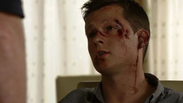  Ben was left battered and bruised in the attack which killed his partner, Paul