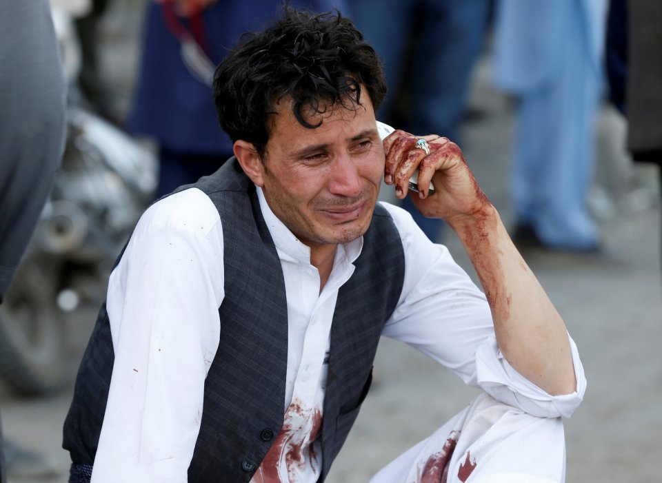  An Afghan man talks on his phone after a suicide attack in Kabul