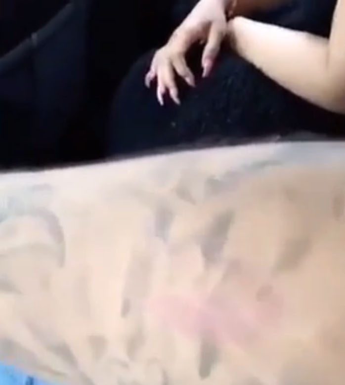  He filmed his arm and pointed out what appeared to be a painful-looking scratch