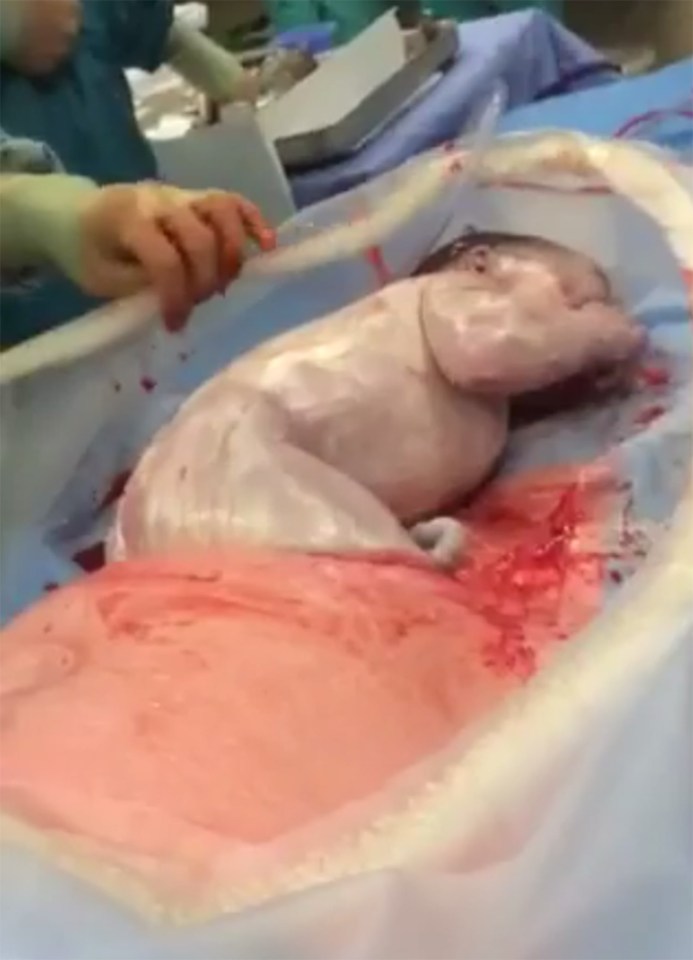  The 'beautiful' birth has been watched by thousands and thousands of people