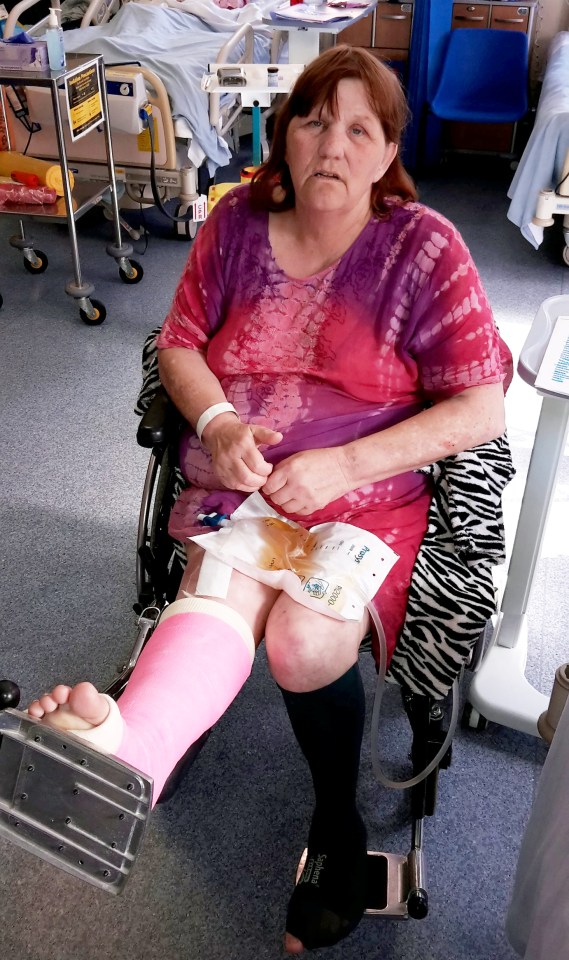  Jane Moran, 63, had her kneecap shattered by a six year old on a scooter