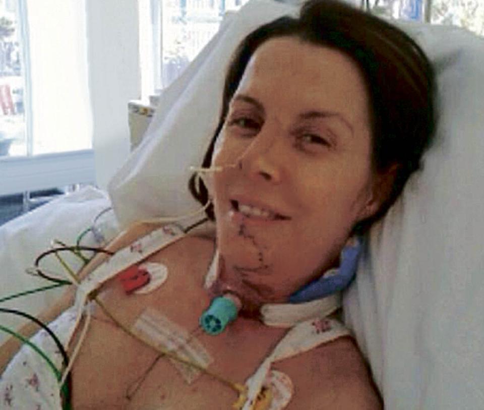  Belinda risked severe scarring and being unable to eat solid food again by having an operation to try to remove the cancer