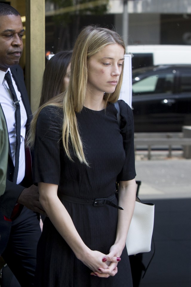  Amber turned up for a court hearing with a bruise on her face