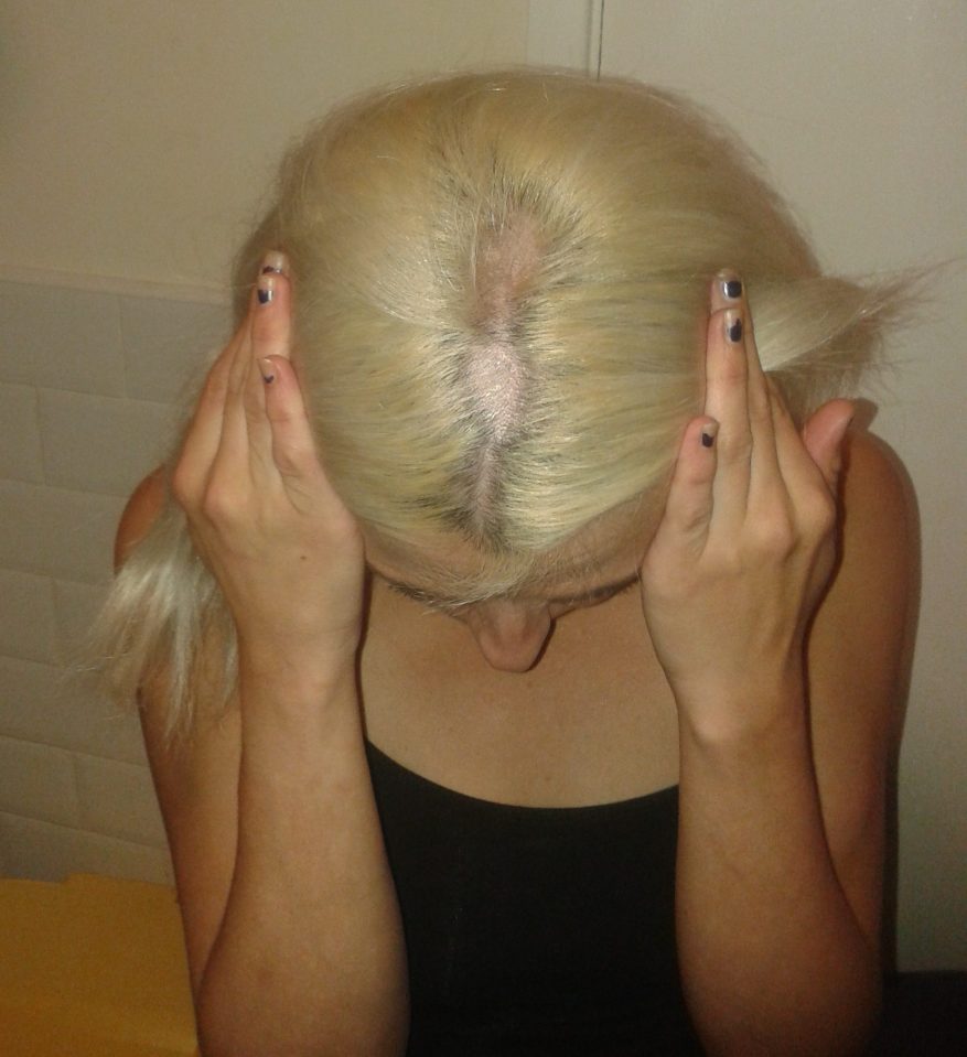  She claims it was caused by a Jerome Russell hair bleaching kit