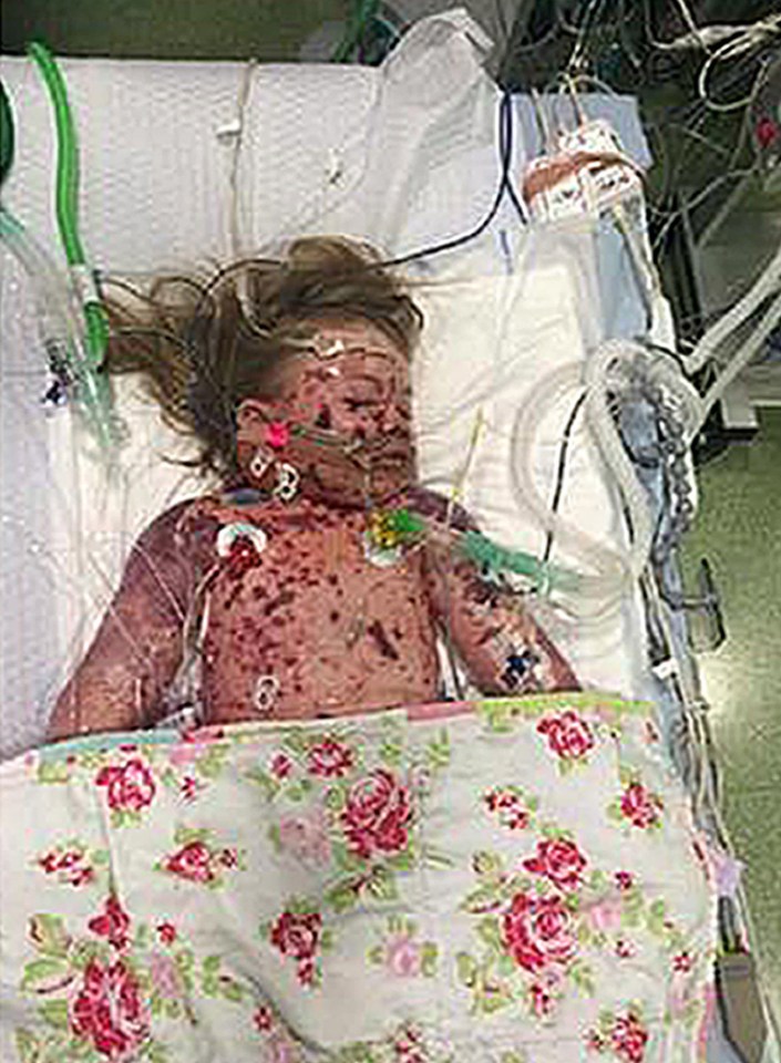  Little Faye was just two-years-old when she lost her battle with killer Meningitis B