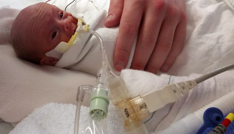 The tiny newborn weighed just over a pound