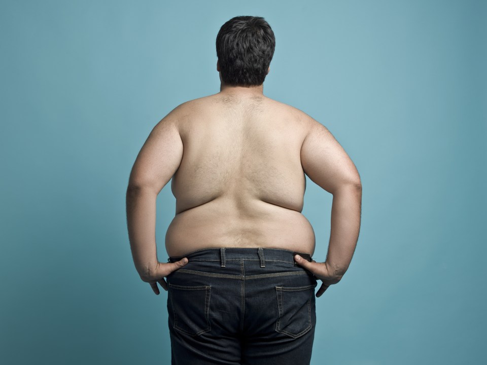  Overweight patients will have to lose weight to qualify for an operation