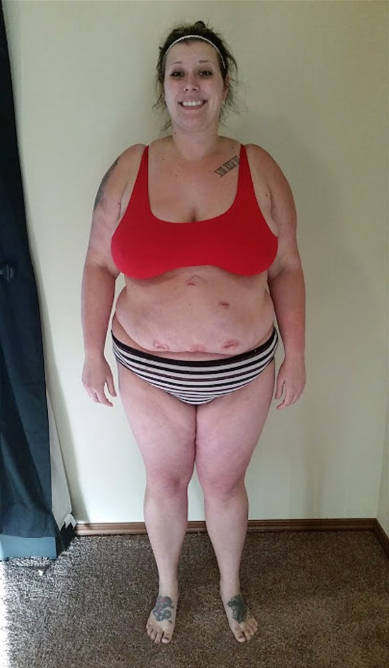  Georgia weighed 23 stone before her gastric bypass