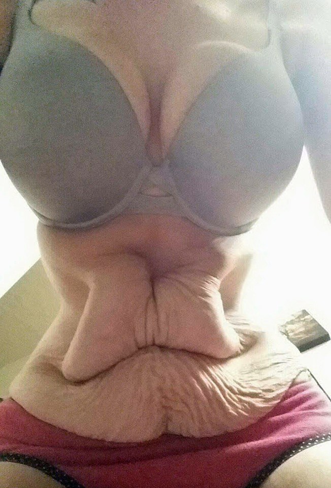  She says her boobs became like 'old lady boobs'