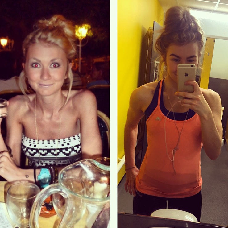  Laura while she was ill (left), and since her recover (right)