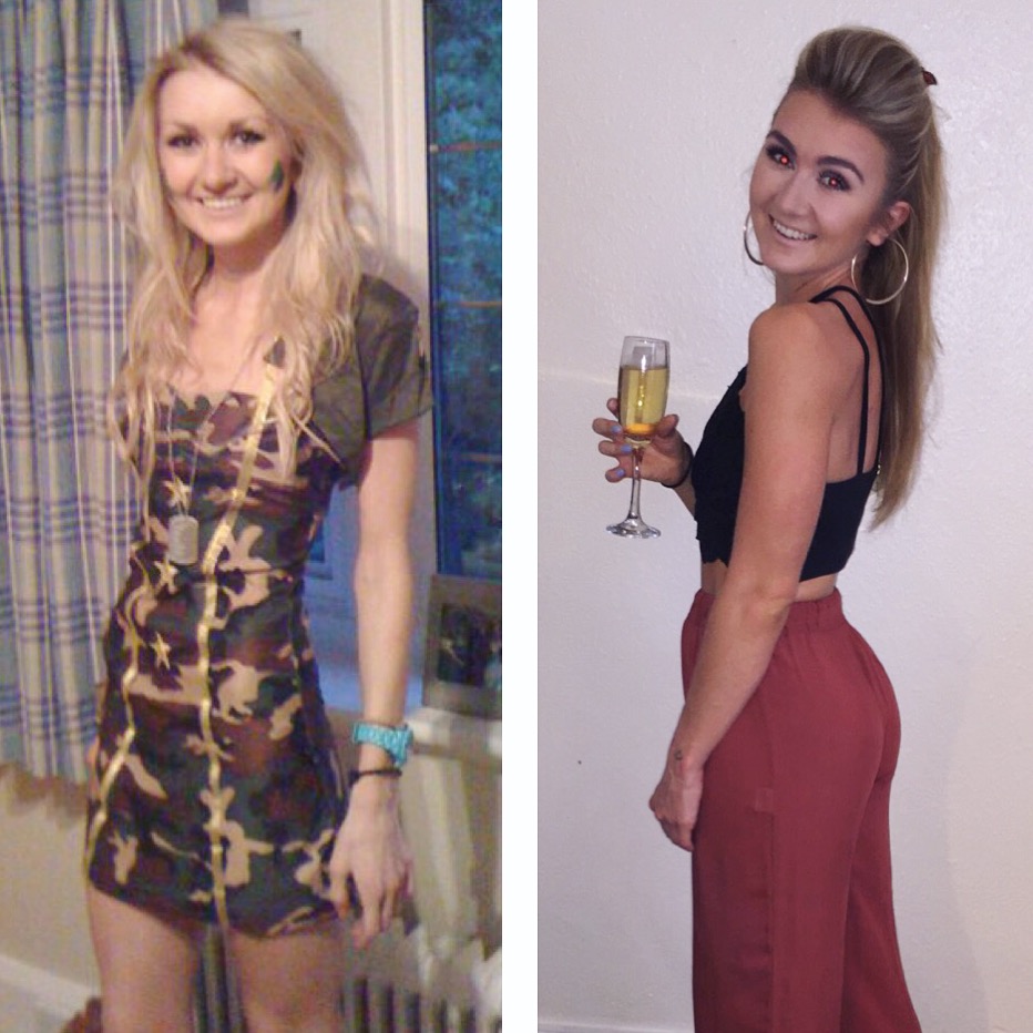  Laura Bardsley, seen before (l) and after (r) her battle with anorexia