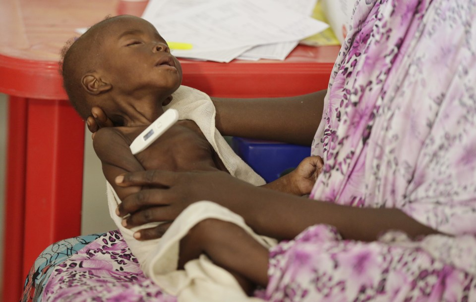  Emaciated ... little baby has his temperature taken at the centre, where medics say one in four kids are dying