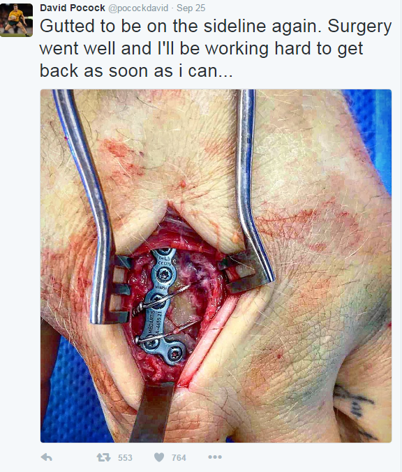  The gruesome picture of David Pocock's hand during surgery