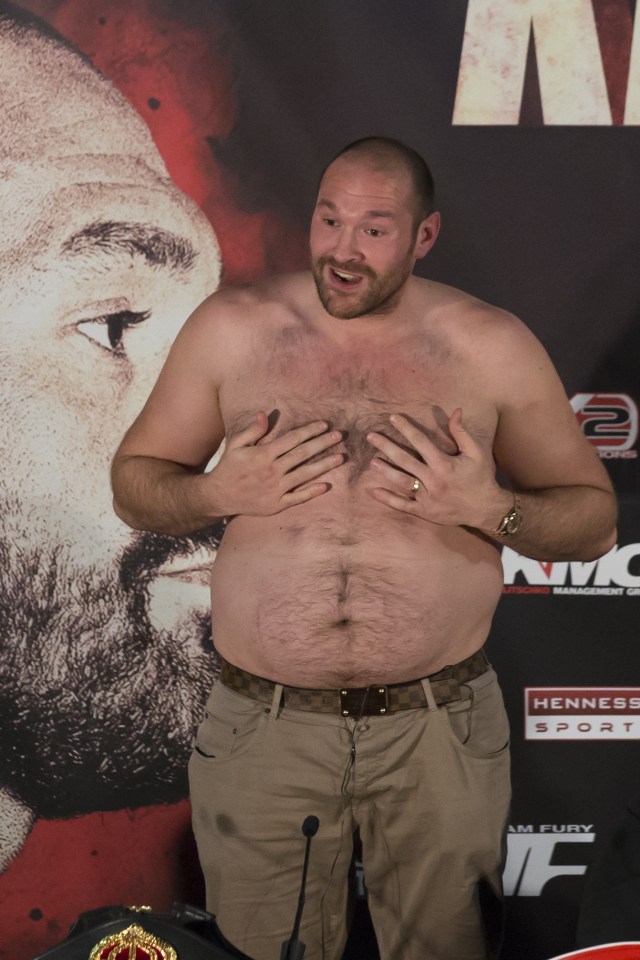 Fury famously took his top off in a bizarre press conference