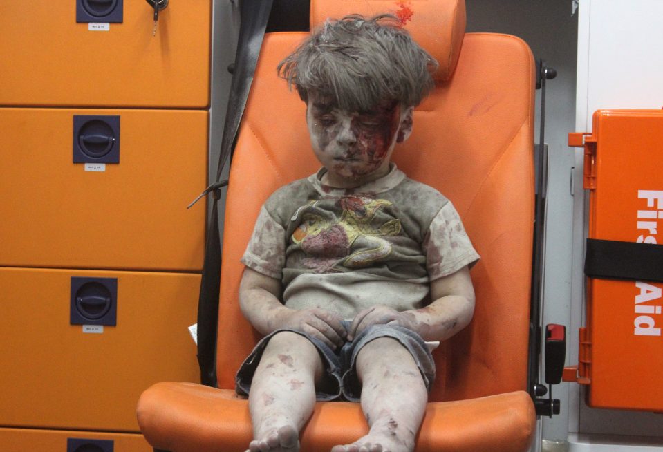  Pictures of youngster Omran Daqneesh, who was treated at the hospital, shocked the world last month