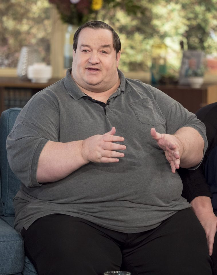  Appearing on This Morning, Stephen Beer, star of reality TV show Too Fat To Work claims the NHS has "let him down" by refusing him weight-loss surgery