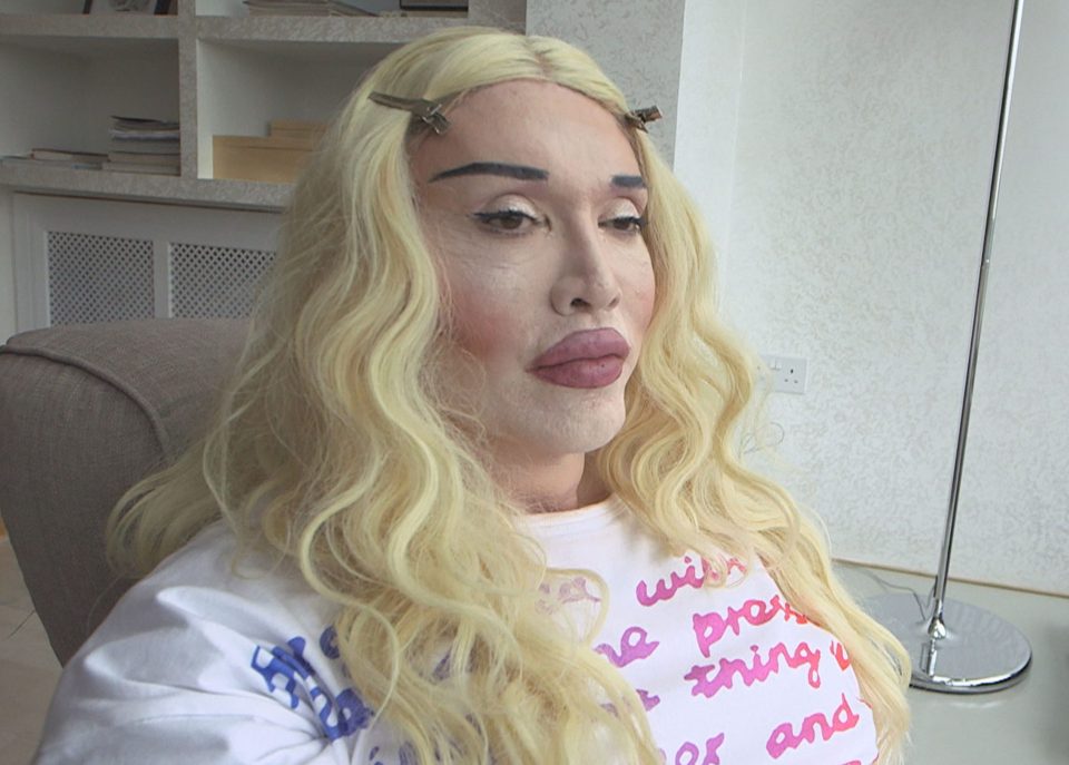  Pete Burns has spoken of his surgery horror on Channel 5's Celebrity Botched Up Bodies