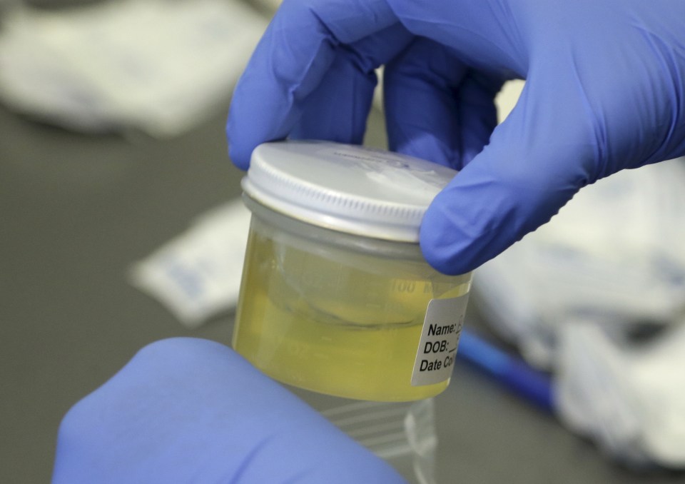  A Florida Department of Health employee processes a urine sample to test for the Zika virus